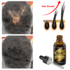 Oem Hair Regrowth Oil Moroccan Hair Oil for Hair Growth