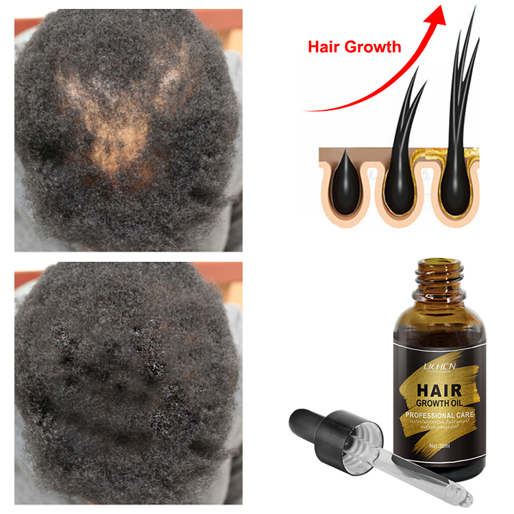 Oem Hair Regrowth Oil Moroccan Hair Oil for Hair Growth