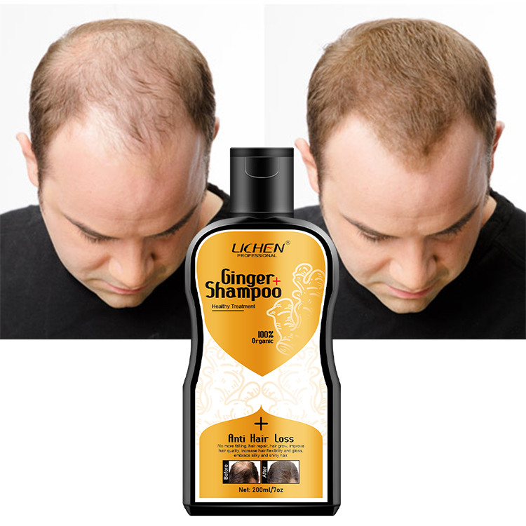 Professional herbal hair growth shampoo organic ginger shampoo for hair loss