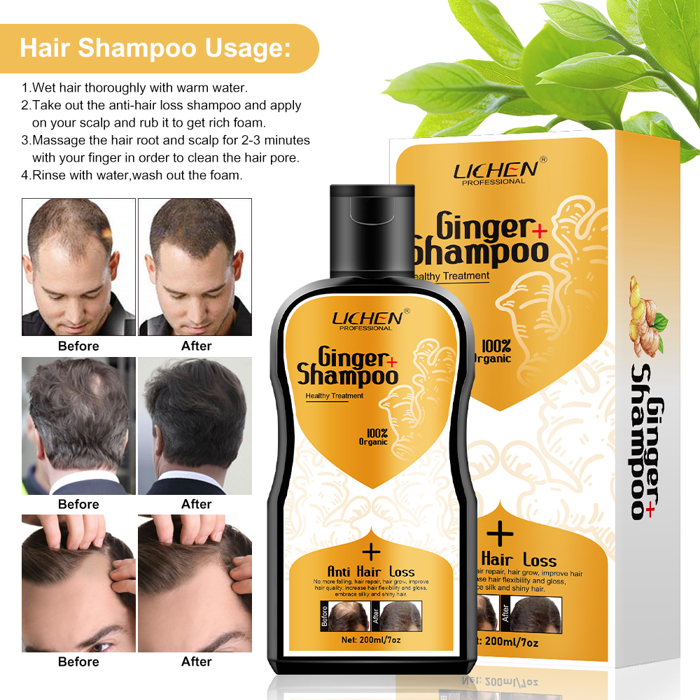 Vegan Scalp Care Anti Dandruff ginger hair thickening shampoo best shampoo for hair fall