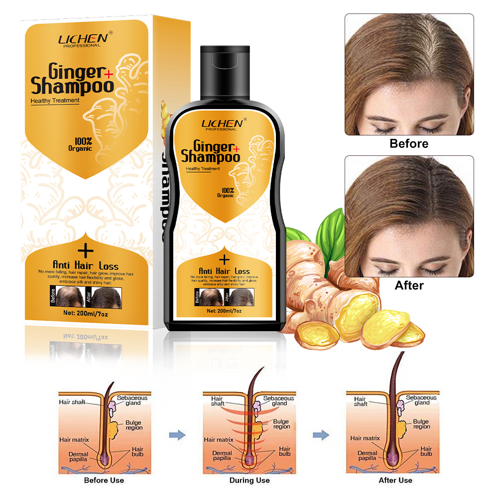 Vegan Scalp Care Anti Dandruff ginger hair thickening shampoo best shampoo for hair fall
